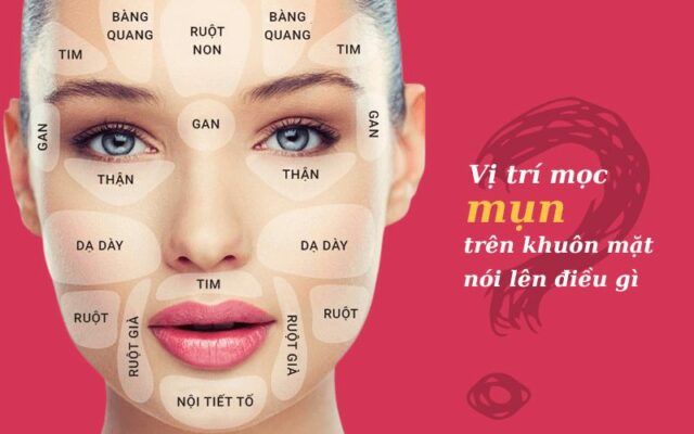 Các vị trí mụn trên khuôn mặt nói lên điều gì